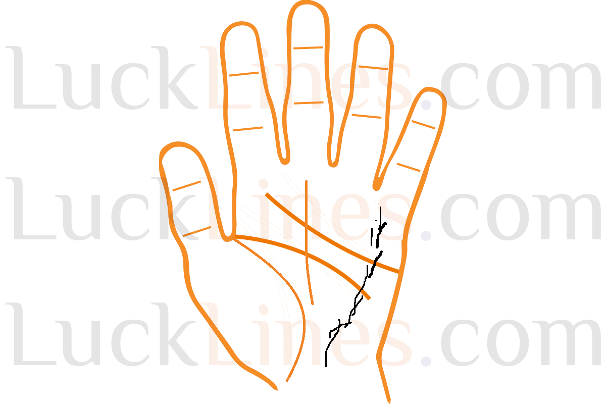 हथेली पर अंकित बुध रेखा का नज़दीकी दृश्य, जो तनाव, चिंता और स्वास्थ्य प्रवृत्तियों का संकेत देती है।